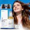 Haarwuchsserum Roll-On 30ml Für Dünner werdendes Haar & Alle Haartypen Nährende Kopfhaut Fördert Haarwachstum Serum Öl Roll-on Serum Öl, 30ml