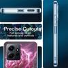 The Cerebral Cortex And Key Components Phone Case For Redmi 12 13C 12C 15C 9 10 10C Note 13 Pro Plus 14 15 Pro 9T 9C 9A TPU Soft