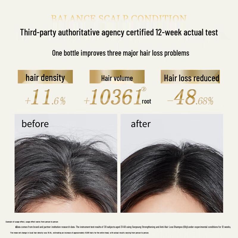 ZIYUAN Soapberry Anti-Hair Loss & Oil Control Shampoo