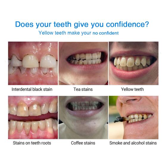 4ml Teeth Whitening Pen Stain Remove Protect Gum Teeth Repair Quick Acting Teeth Whitening Pen for Beauty