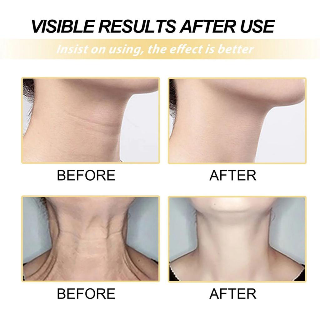 Cream for Neck Skin Care  Face Creams for Women Skin Whitening Cream  Crema Para Manchas De La Cara