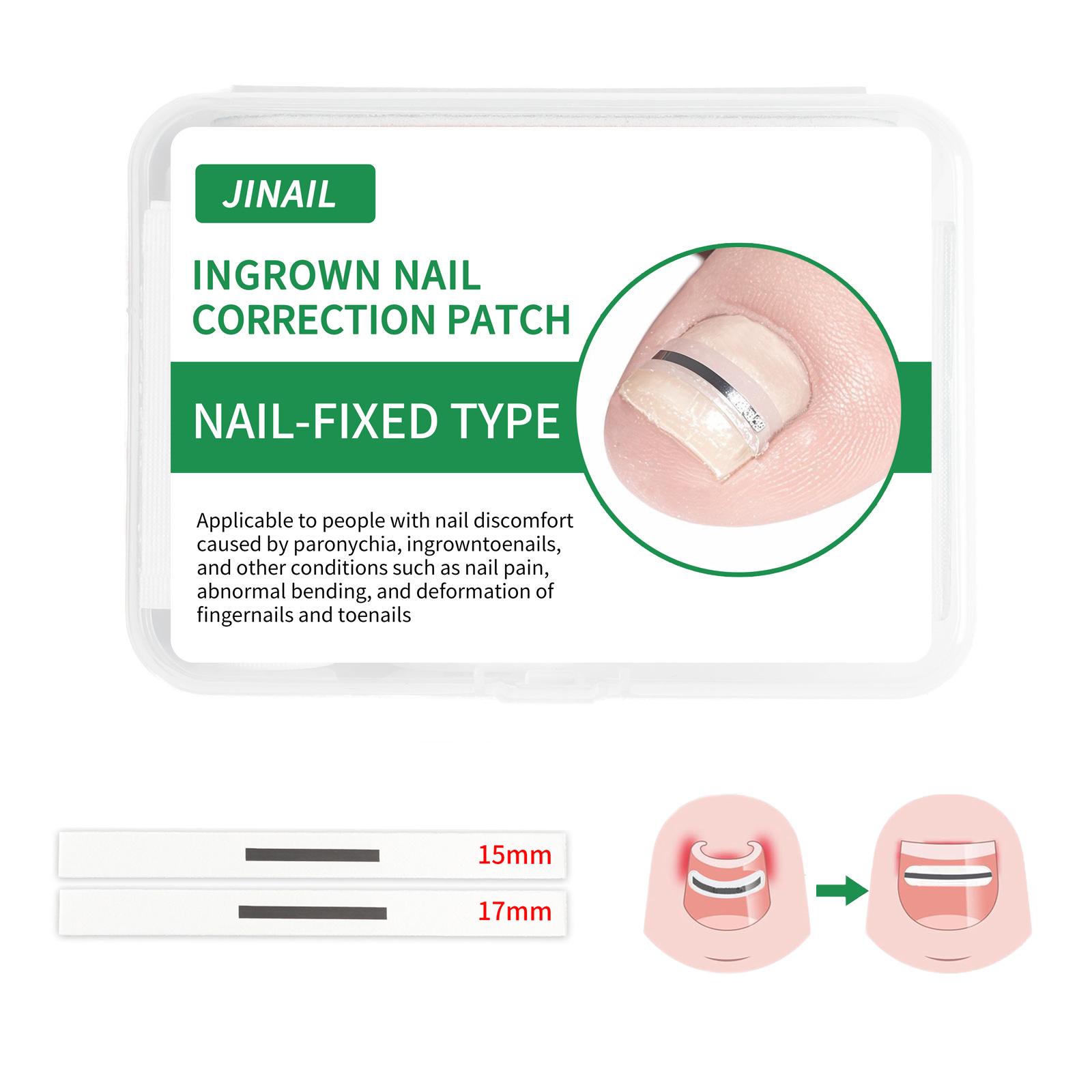 

Разработан для ремонта искривленных ногтей и коррекции вросших ногтей, инструментов для ногтей и набора для удаления вросших ногтей 1PC