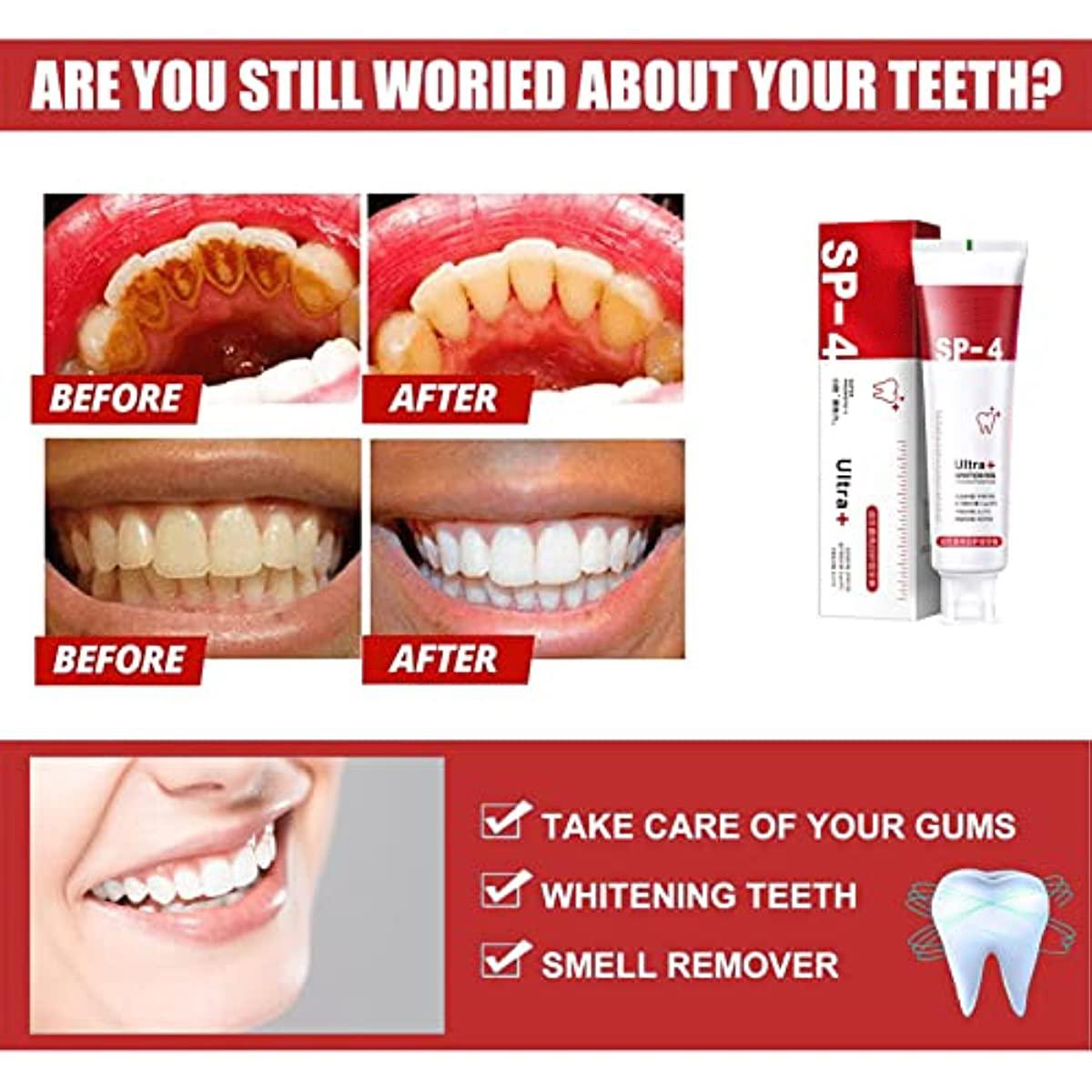 Global white система для домашнего отбеливания зубов 4-5 тонов. Sip 4 зубная. Зубная паста fresh white 160gr whitening gel. Colgate optic white зубная паста ехр 8187mx111i made in mexico. Sip 4 зубная.