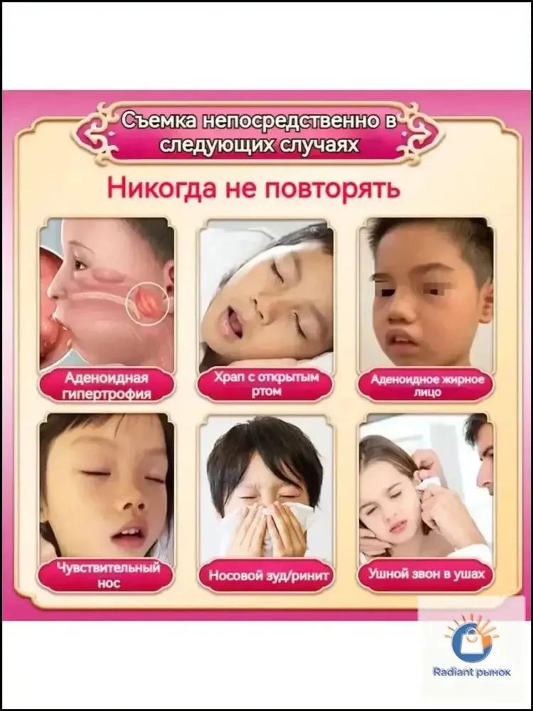 Patch of traditional Chinese medicine from hypertrophy adenoids Xiuyishu for correction of baby face, 1 box