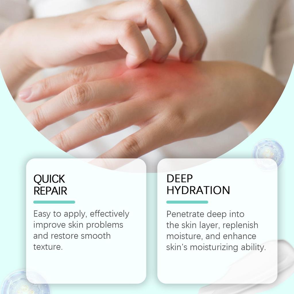 Hyaluronic Skin Care Cream Body Skin Moisturizing Moisturizing Gentle Skin Care Cream