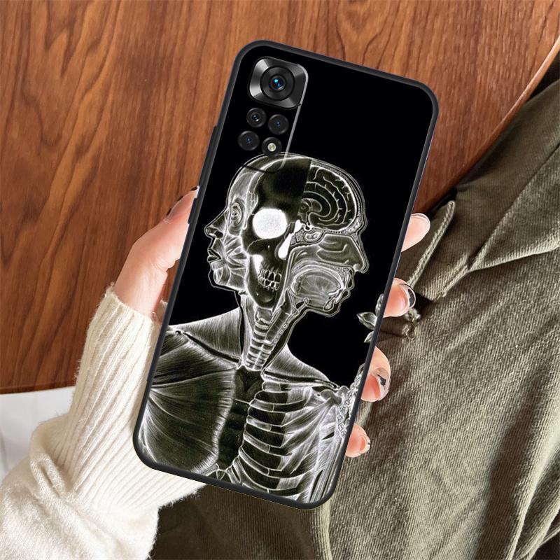 Medical Skeleton Anatomy Case For Xiaomi Redmi Note 13 14 Pro 12 11 10 15 Pro Plus Redmi 15 C 13 10C 12C 13C 14C Cover