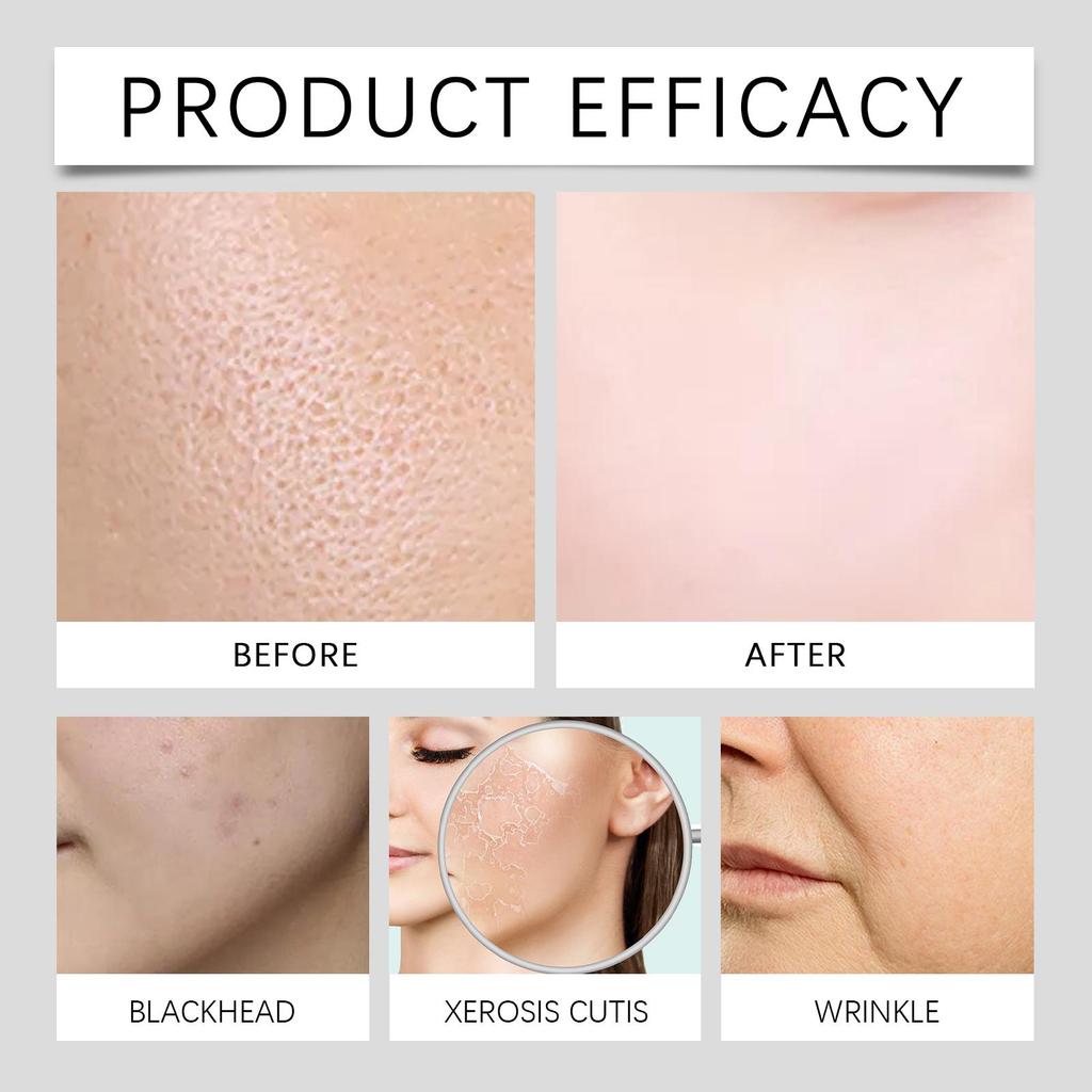 EELHOE Hyaluronic Acid Facial Set 1 Set, Gentle Hydration, Nourishing Skin Roller, Firms and Smooths Skin, Reduces Fine Lines, Facial Care