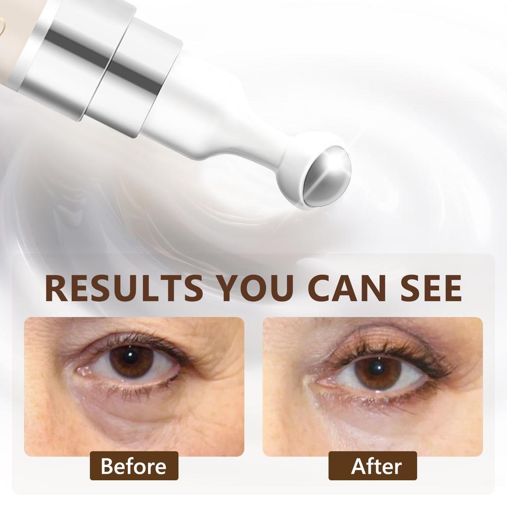 Coffee Essence Eye Cream-Hydration And Nourishment With Coffee Oil & Vitamin E-Lightweight Moisturizing No Greasy-Suitable For All Skin Types, 15ml