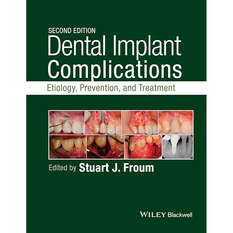 Ergode India Books Dental Implant Complications: Etiology, Prevention, And Treatment