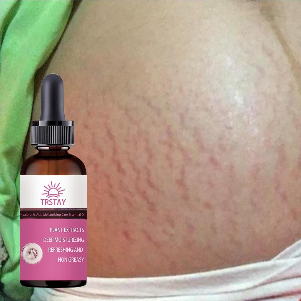 Těhotné ženy opravují břišní vrásky, poporodní opravný krém, preventivní tělový krém, hydratuje pokožku, odstraňuje těhotenské vrásky, tukové vrásky, krém na obličej