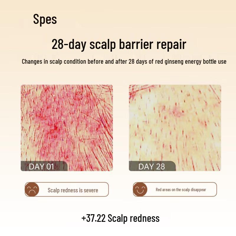 Spēs Hyaluronic Acid Red Ginseng Oil Control Anti-Dandruff Shampoo