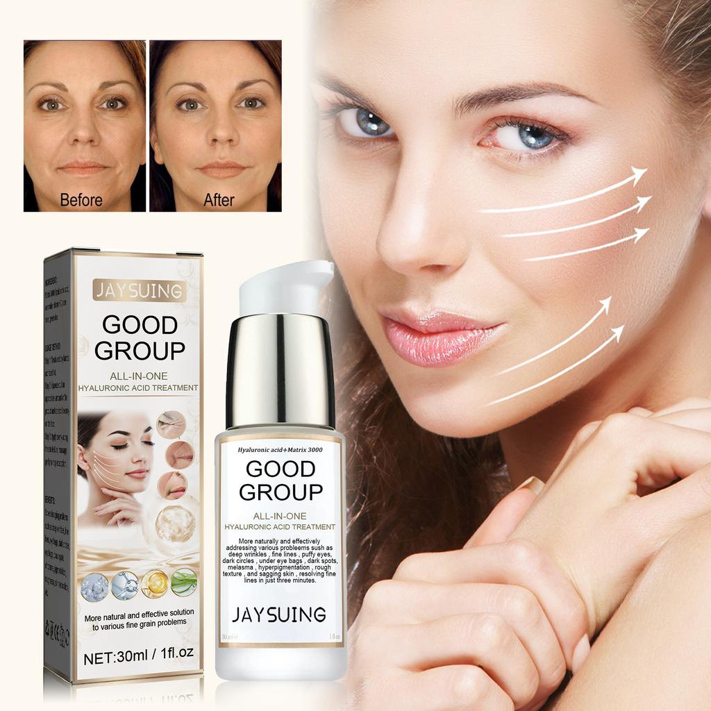 Hyaluronic Acid Anti-Aging Serum Lightens Dark Circles, Wrinkles, Firms and Brightens Skin