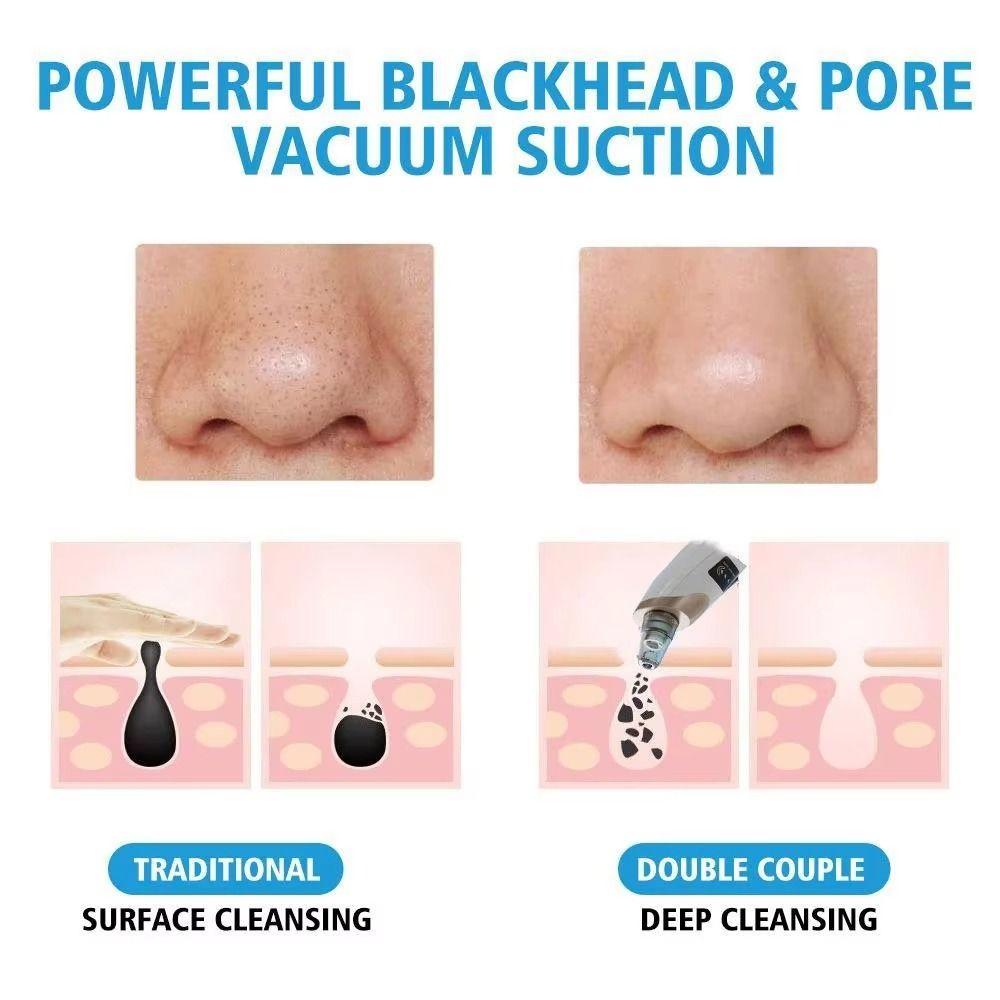 3 Suction Mode Electric Blackhead Remover Deep Cleansing Face Cleansing Machine  Dead Skin Removal