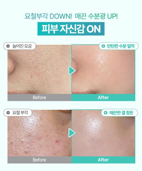 FreshLime LHA Glow Pore Serum 50ml