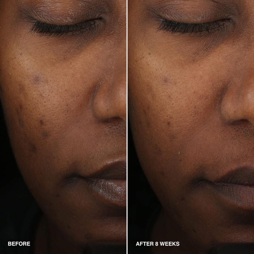 Bobbi Brown Vitaminangereichertes Glättendes Serum Mit Niacinamid + Vitamin C 1.014 Unzen   30 ml 1.014 Unzen   30 ml