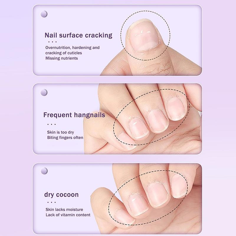 3v1 Keramický olej na nehtovou kůžičku Rozjasňující Hydratační Odstraňovač nehtové kůžičky v peru Vyživující Esence pro péči o nehty v peru Oprava poškození nehtů