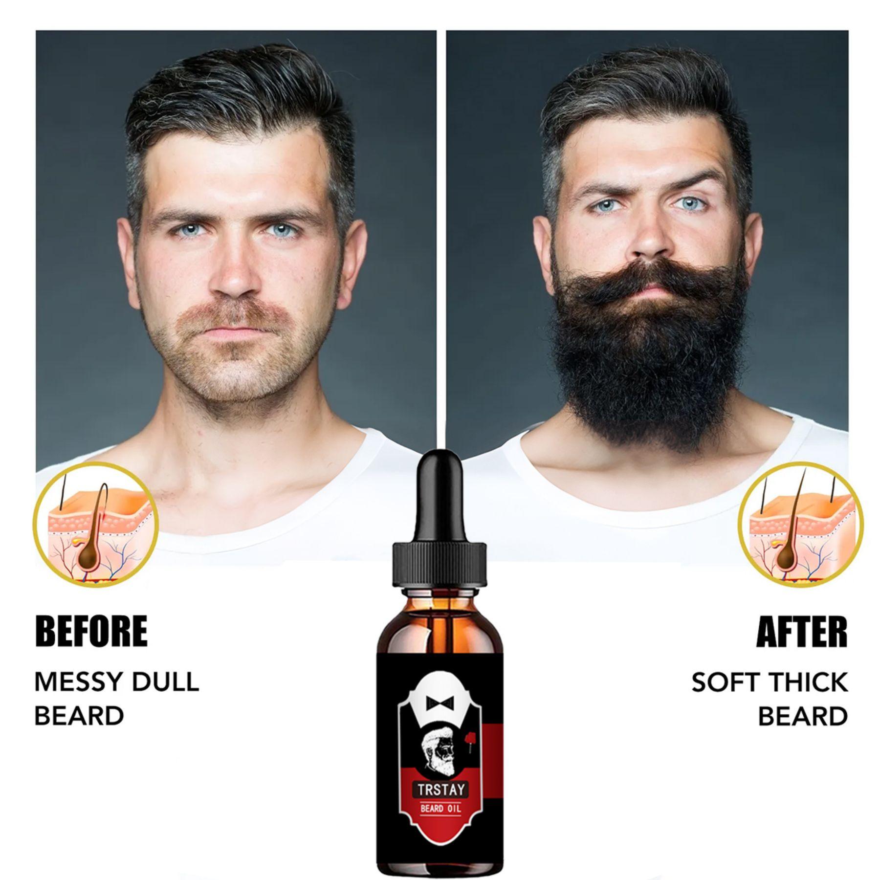 

Масло для волос Beard Oil для быстрого роста волос Рост бороды 5ml