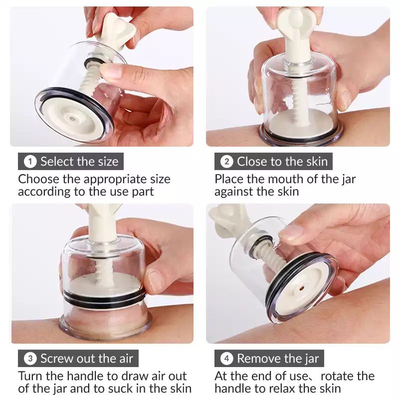 SHARE HO 5 Storlek ABS Vakuumkoppar Burkar Handvridna Anti-cellulit Massagekoppar Roterande Sugkopp Kinesisk Terapi Hälsovård