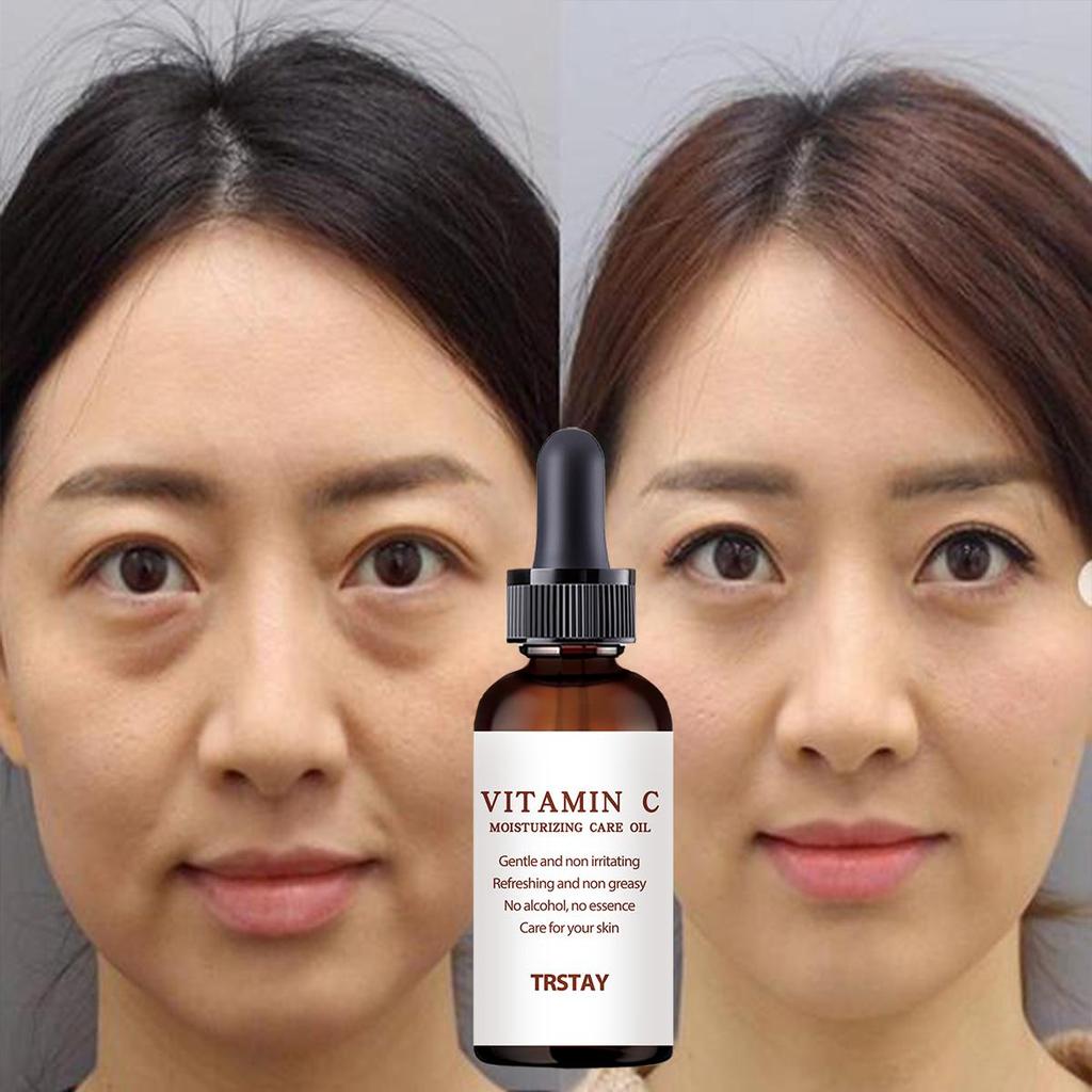 Botoxup Face Cream, Tightens, Moisturizes Skin Face Cream, Restore Youthful And Smooth Skin