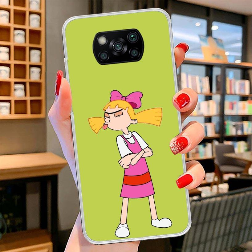 Cartoon Hey Arnold Fondos Cover Phone Case For Xiaomi Poco F7 Ultra X7 X6 X5 Pro M7 Redmi 15C 15 13C 13 12C 12 10C 10 9A 9C 9T 9