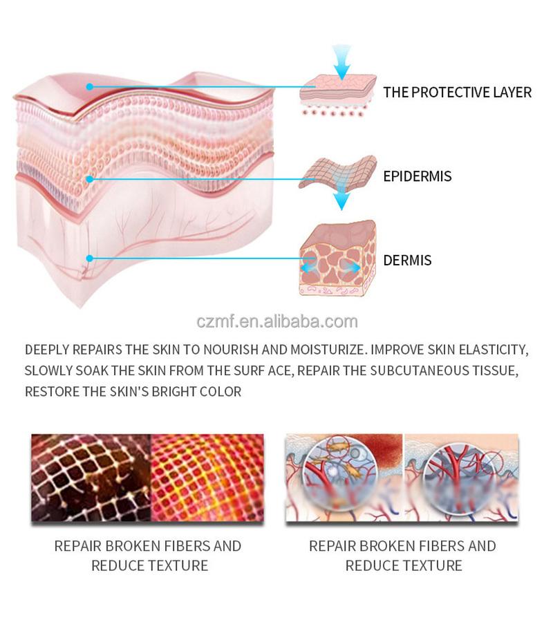 Natural Organic Postpartum Stretch Mark Removal Skin Repair Cream Body Pregnancy Scar  Cream For Women