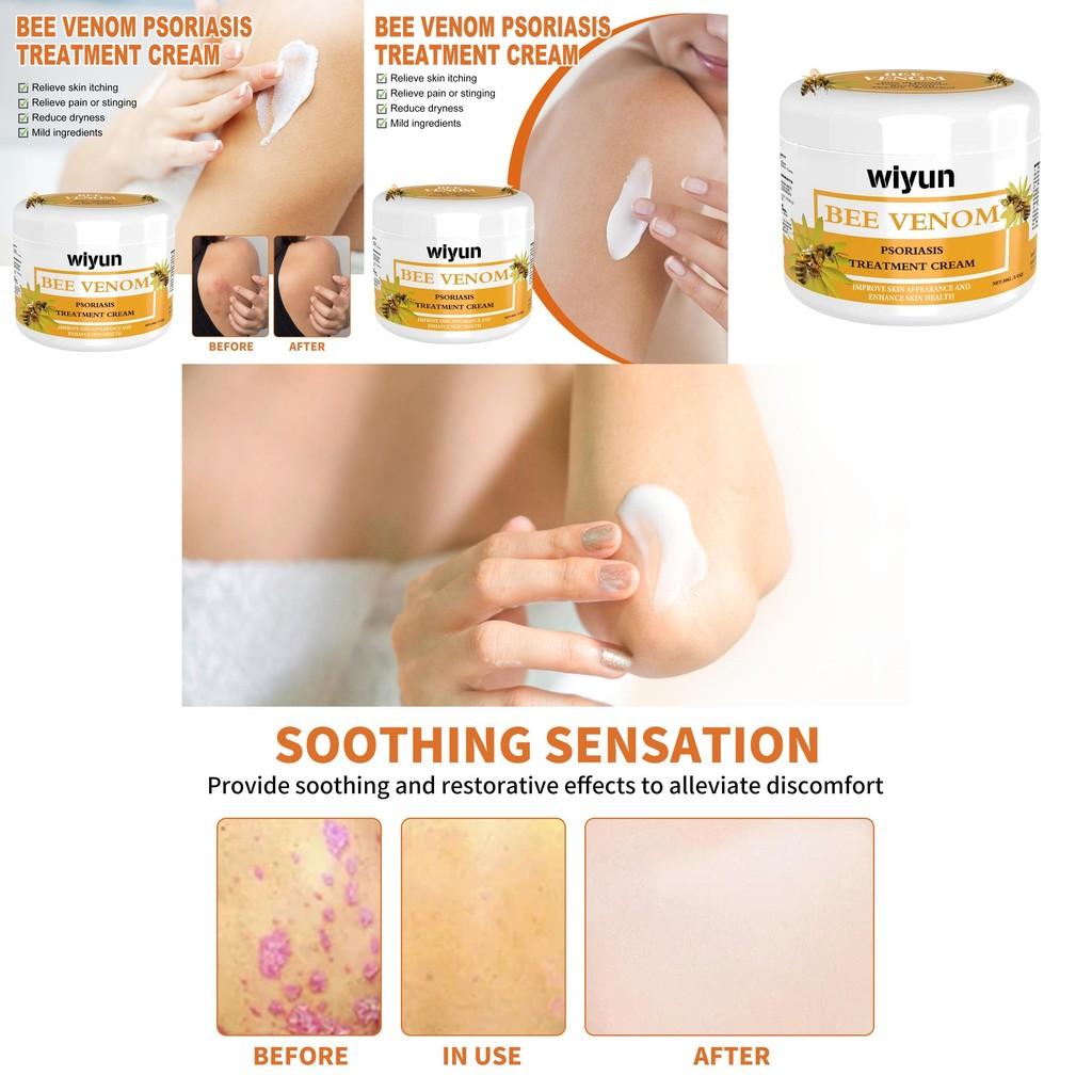 Premium Wiyun Bee Venom Skin Cream For Repairing Dry And Itchy Skin With Soothing Hydration