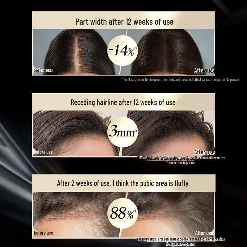 Schwarzkopf Anti-Hair Loss & Repair Shampoo