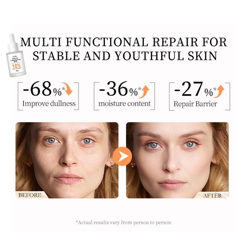 MOIKA Whitening Freckle Removing Essence Skin Tone Serum Fade Acne Mark Brightaening Beauty Skin Care Products 30ml