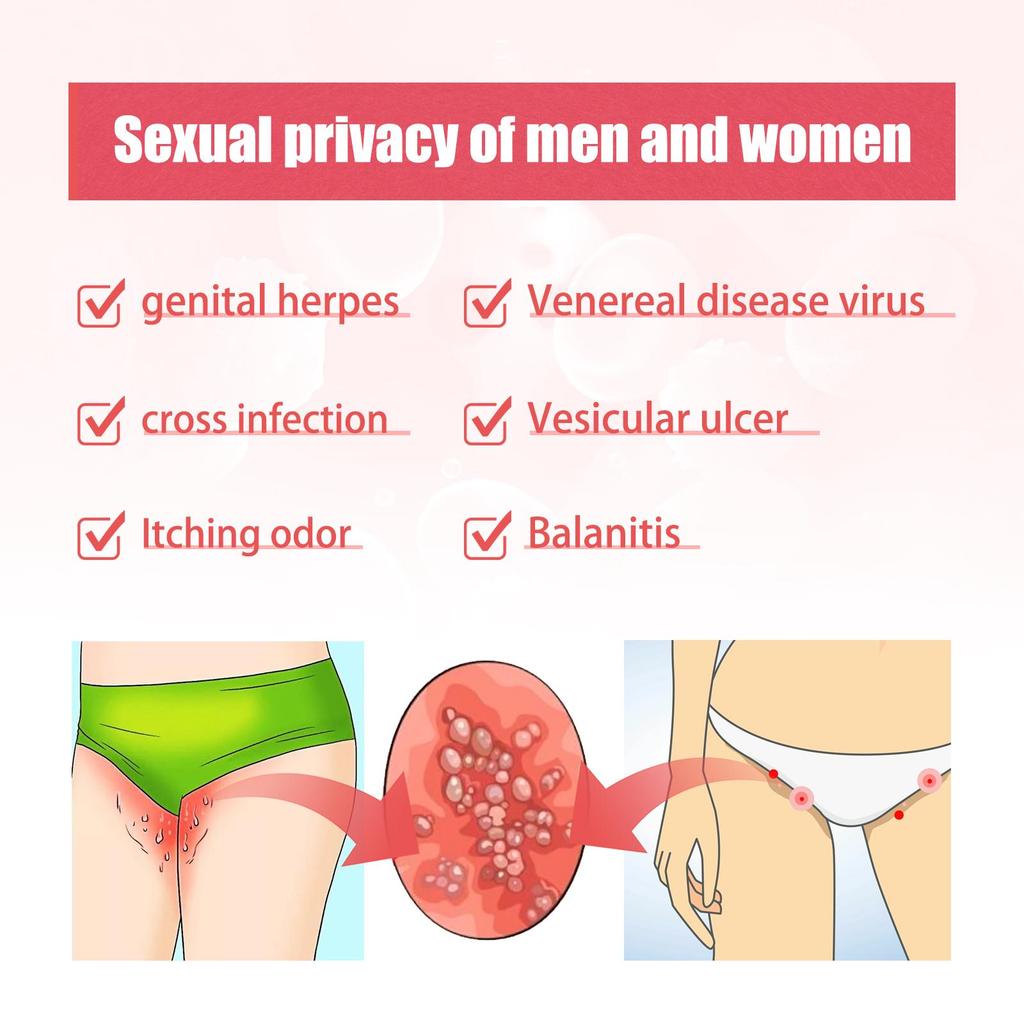 SouthMoon Inner Leg Balm Women's Private Parts Odor Removing, Moisturizing, Skin Repairing Balm