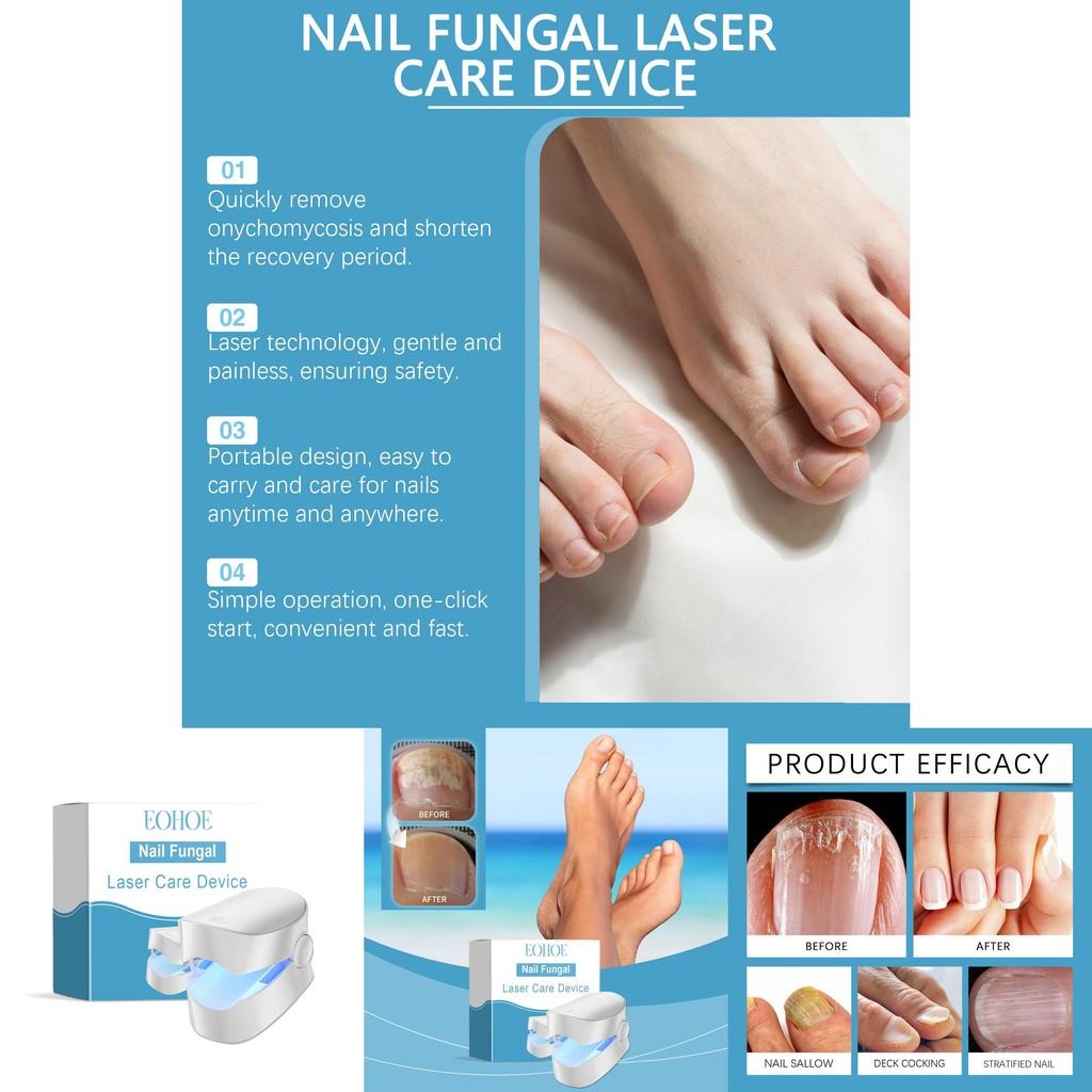 Eohoe Hand Nail Care Device For Gentle Nourishing Strengthening And Fortifying Nails