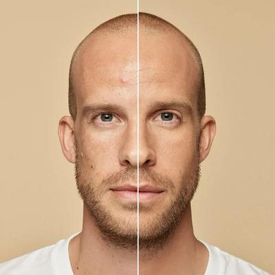Perfect Accord Hyaluronik Asit Fondöten - 7R Amber Rose - 