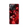 Blood Platelets Under Microscope Phone Case For Xiaomi Poco F7 Ultra X7 X6 M8 M7 M6 M4 M3 Pro X4 Mi 15 15T 14 14T 12T 12S 10T Pr