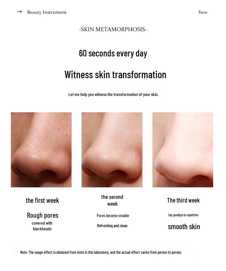 Electric Blackhead Remover: Visual Beauty Instrument for Pore Cleansing and Facial Suction