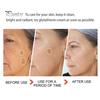 2/3 Pcs Soap Beauty Set Lighten Pigmentation Scars Soften Dark Circles Soap Mineral-rich Beauty Products