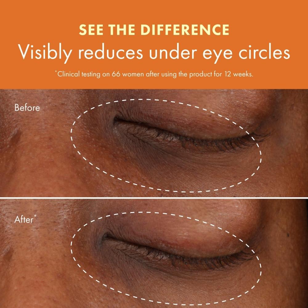 Origins Ginzing  Vitamin C Eye Cream 0.5 Oz 15 Ml Warm