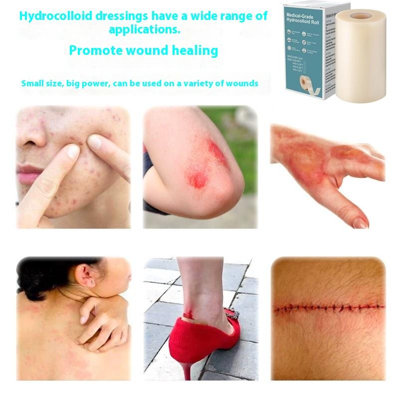 Hydrokolloid-Rolle zur Wundversorgung Hydrokolloid-Pflasterverbände mit selbstklebenden Dekubitusverbänden Hochabsorbierend für Verbrennungen