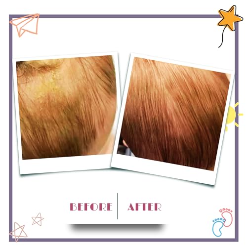 2-delat set med babykrämskrapa och badborste, Mjuk massageborste för nyföddas hår, Skonsam krämskrapa, Lila