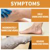 Premium Varicose Vein Repair Cream Relieves Soreness Swelling And Bulging Veins