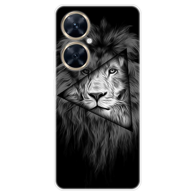 Für Huawei nova 11i nova11i Fall Weiche Silikon Zurück Abdeckung Cartoon Telefon Fall Diversifizierung