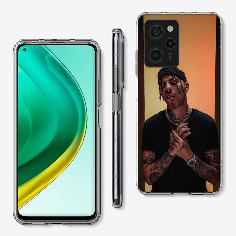 R-Rauw Alejandro Rapper Cover Telefonfodral För Xiaomi Poco M8 M7 M6 M4 M3 X7 X6 X4 Pro F7 Ultra M5S Mi 14 14T 15 15T 12T 10T Pro 1