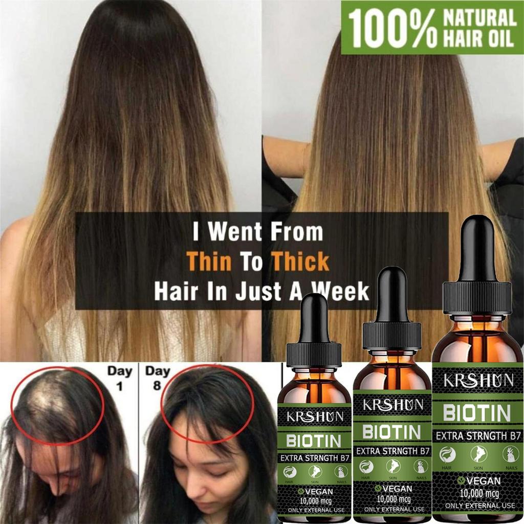 Huile de croissance capillaire entièrement naturelle pour rendre les cheveux plus épais et plus longs et stimuler la croissance des cheveux Produits capillaires Huile de croissance pour femmes noires