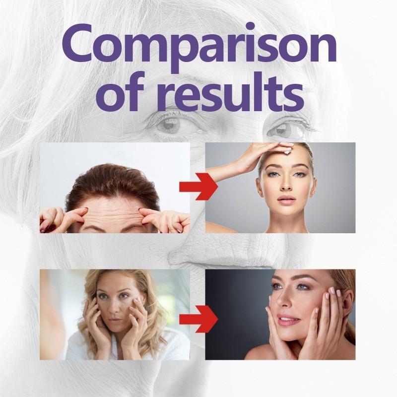 Eelhoe Tightening Facial Essence For Youthful Skin With Wrinkle Repair Hydration And Firmness 30ml