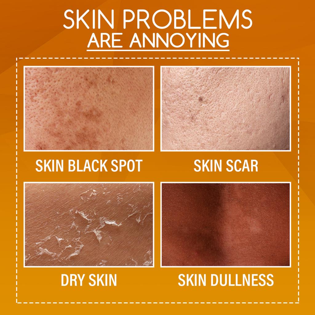 Orange Peeling Lotion for Dark Skin Bleaching Exfoliating Removes Dead Skin Cleaning Moisturizing Brightening Strong Peeling Oil