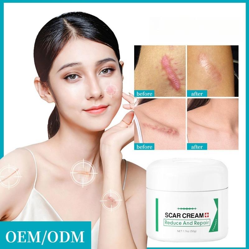 1PC After Burn Fading Skin Ointment