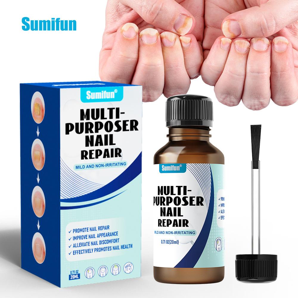 Gray Nail Paste, Thickened Shiny Nail, Gray Nail Repairs, Clean and Soft Nail Paste, Care for Hand, Foot and Toenail Decay