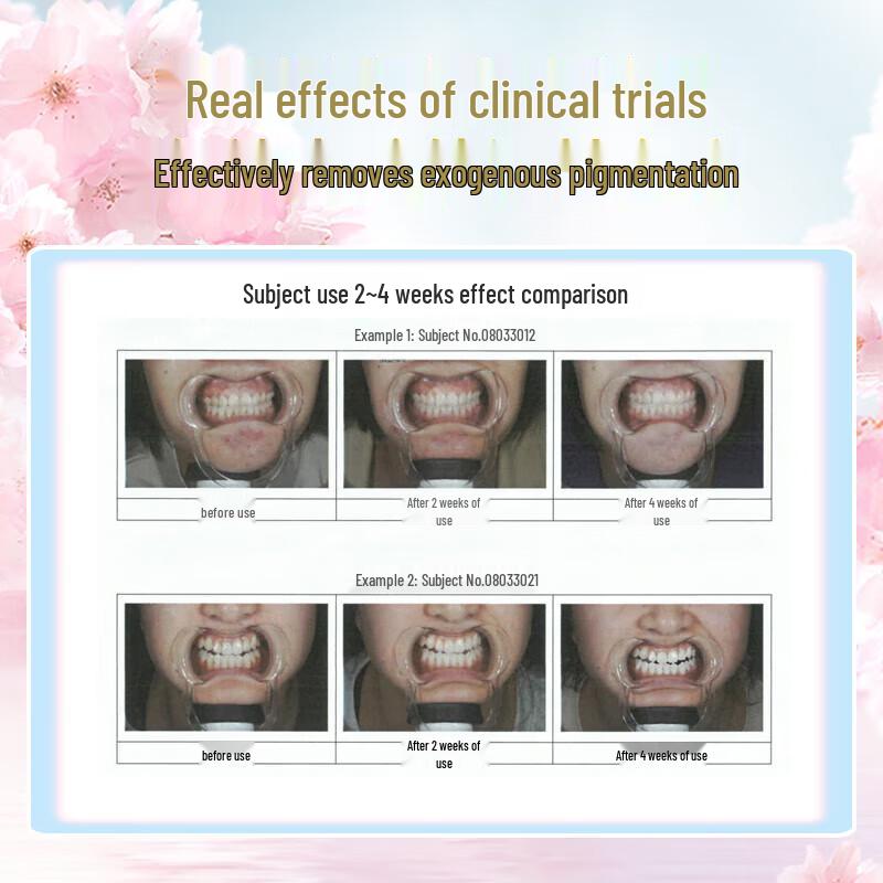 Fe Golden Classic Whitening Toothpaste - Cherry Blossom Mint