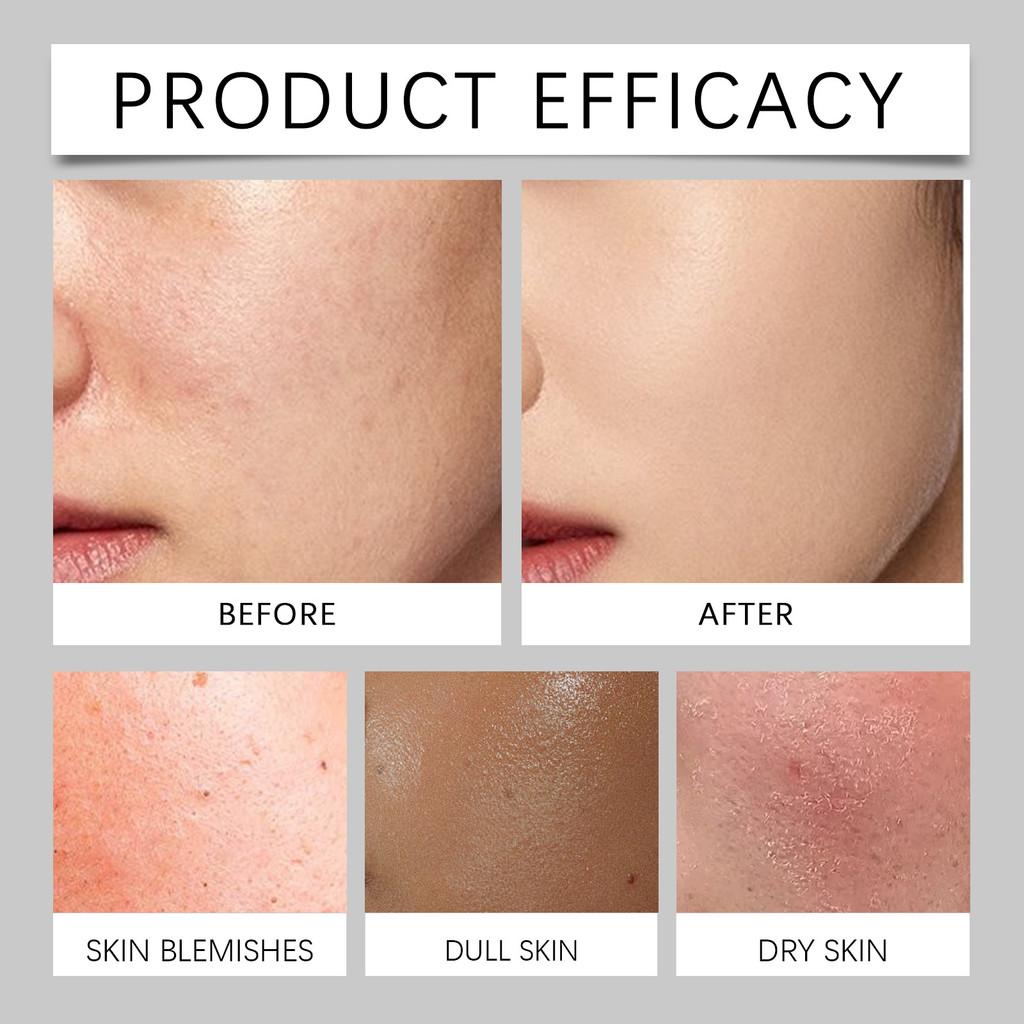 East Moon Men's Hydrating Concealer Cream For Long-lasting Smooth Skin Treatment Ideal For All Skin Types