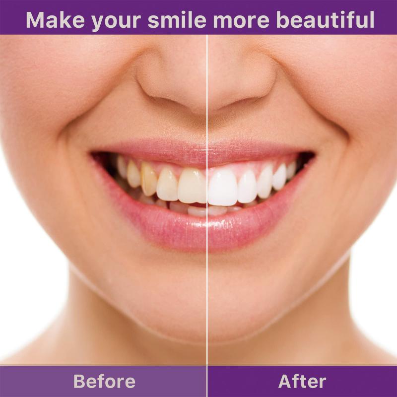 Dentifricio Sbiancante Viola Rimozione Tartaro Denti Gialli Fumo Riparazione Denti Bocca Pulita Dentifricio Bianco