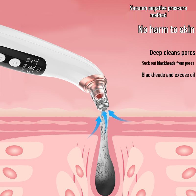 Electric Blackhead & Acne Remover - Deep Cleansing Facial Pore Device