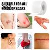 Painless Scar Removal Medical Grade Silicone Sheets Tape Professional Post-surgery Skin Care Treatment Reusable Strip for Keloid C-Section,